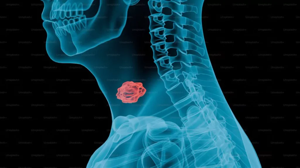 salud-publica-resalta-la-importancia-del-diagnostico-oportuno-y-adecuado-del-can-20261009-122944-Ojwc-1200x675