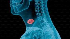 salud-publica-resalta-la-importancia-del-diagnostico-oportuno-y-adecuado-del-can-20261009-122944-Ojwc-1200x675